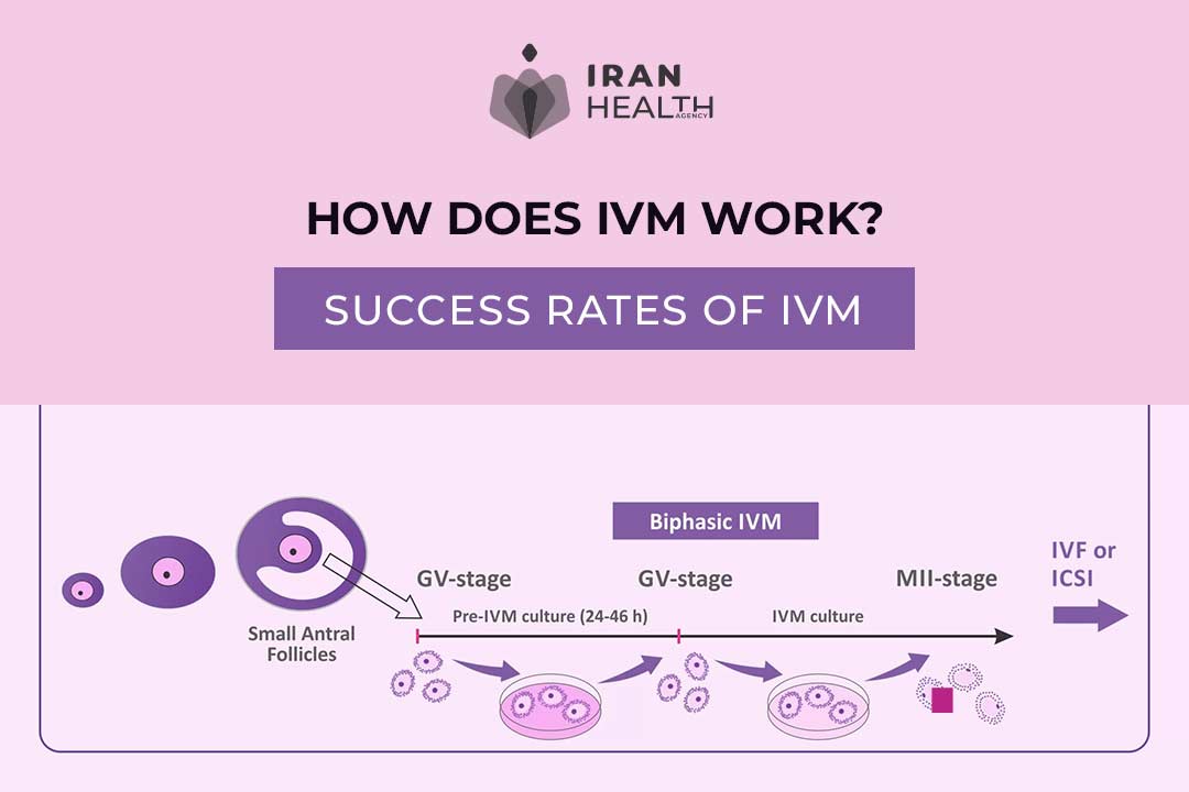 Success rates of IVM