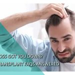 Hair Transplant FAQs Answered: Hair Loss Got You Down?