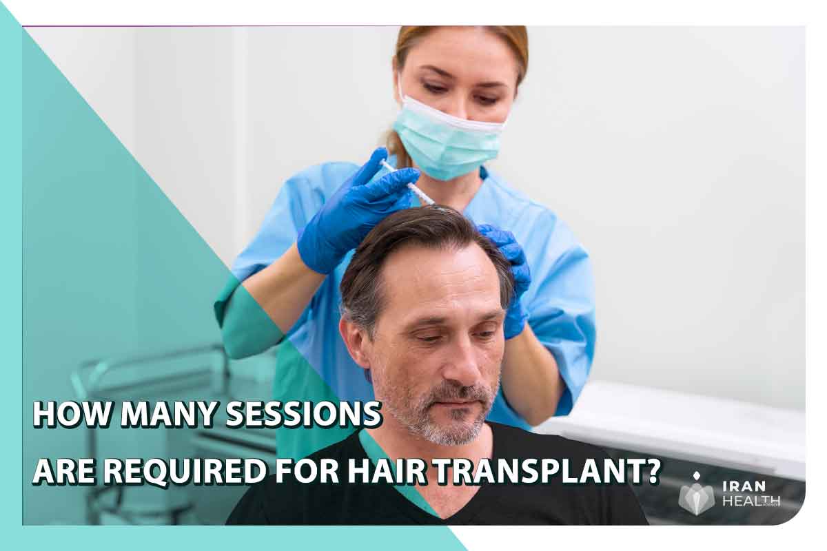 hair transplant sessions count