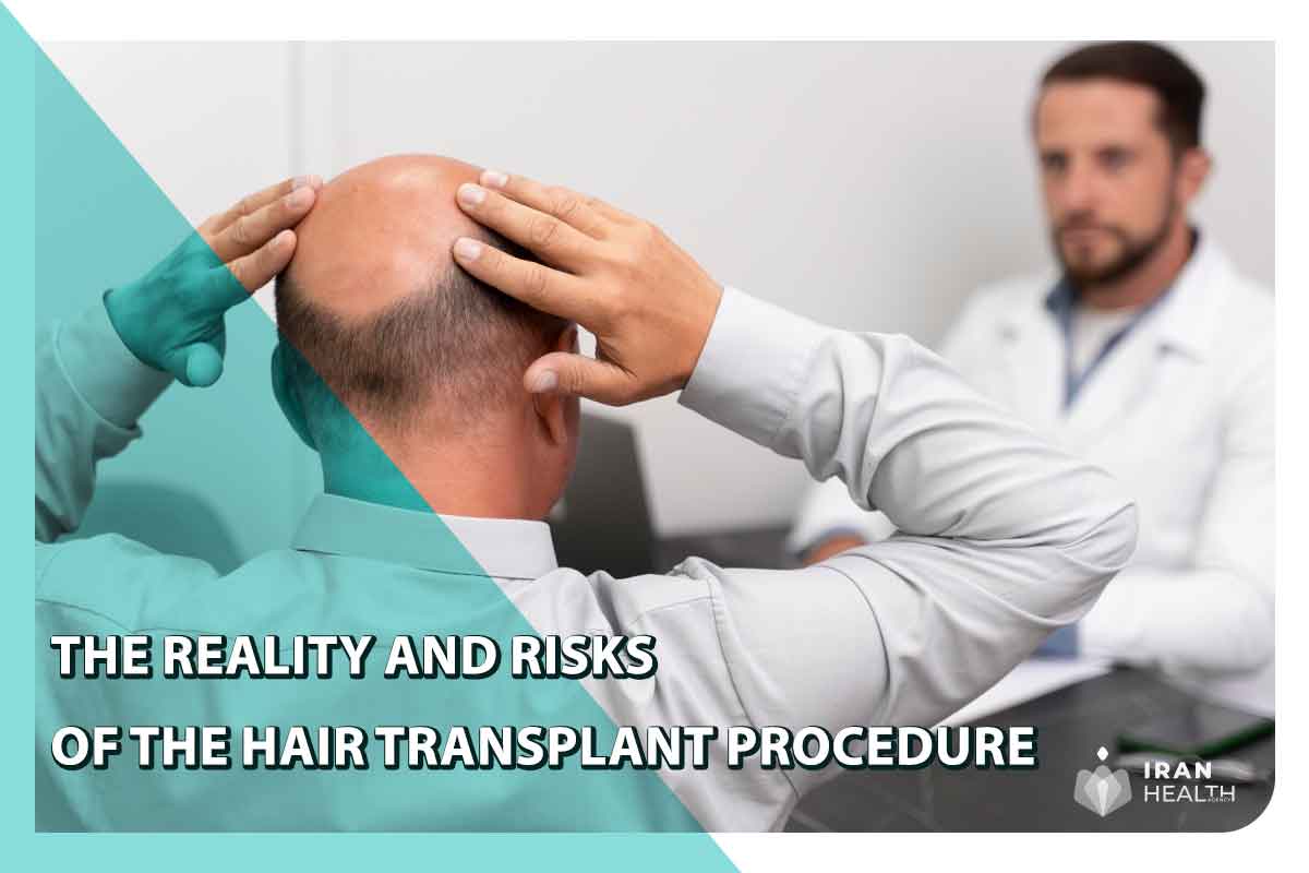 Reality and Risks of the Hair Transplant