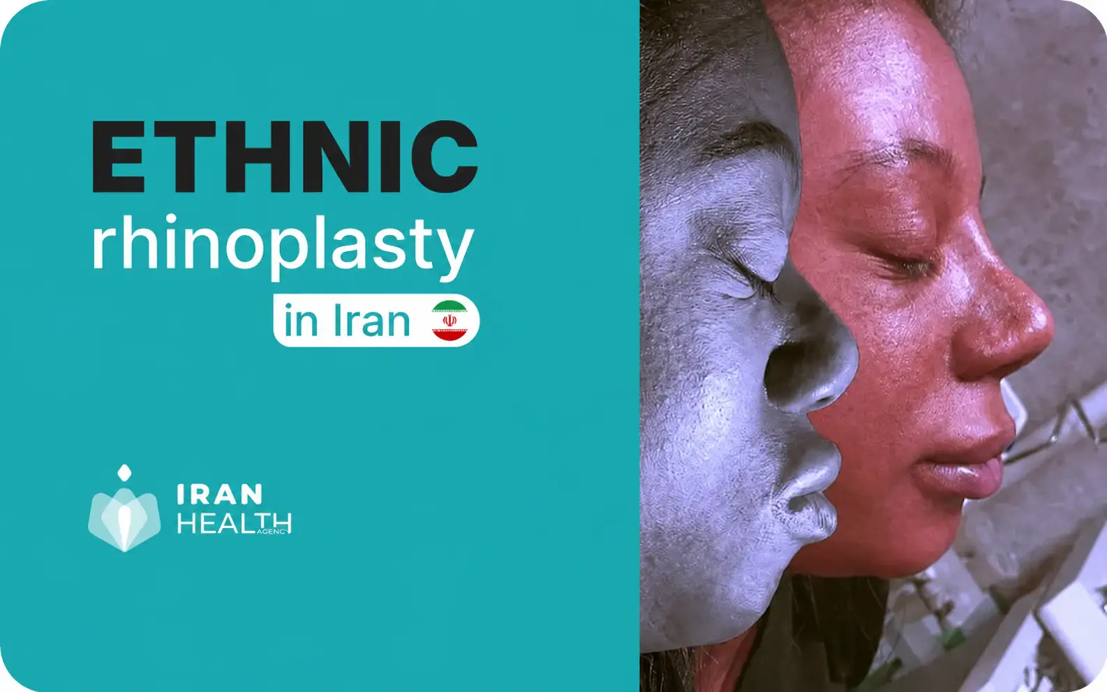 Ethnic Rhinoplasty in Iran 1