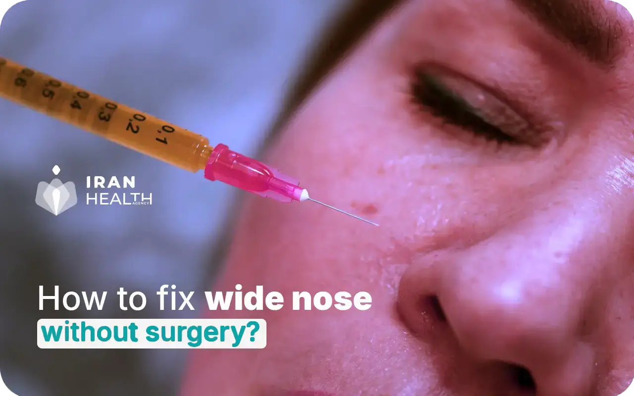How-to-fix-wide-nose-without-surgery