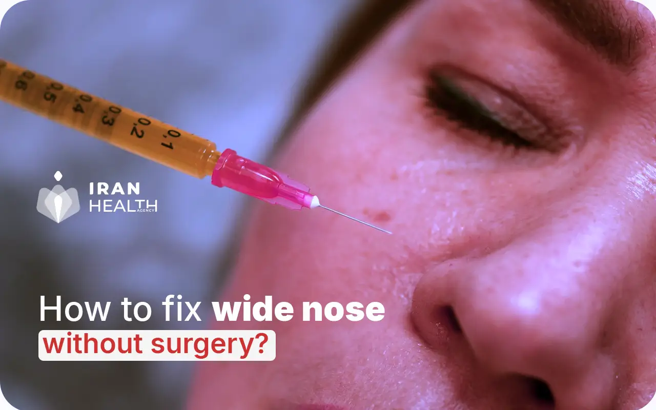 How to fix wide nose without surgery