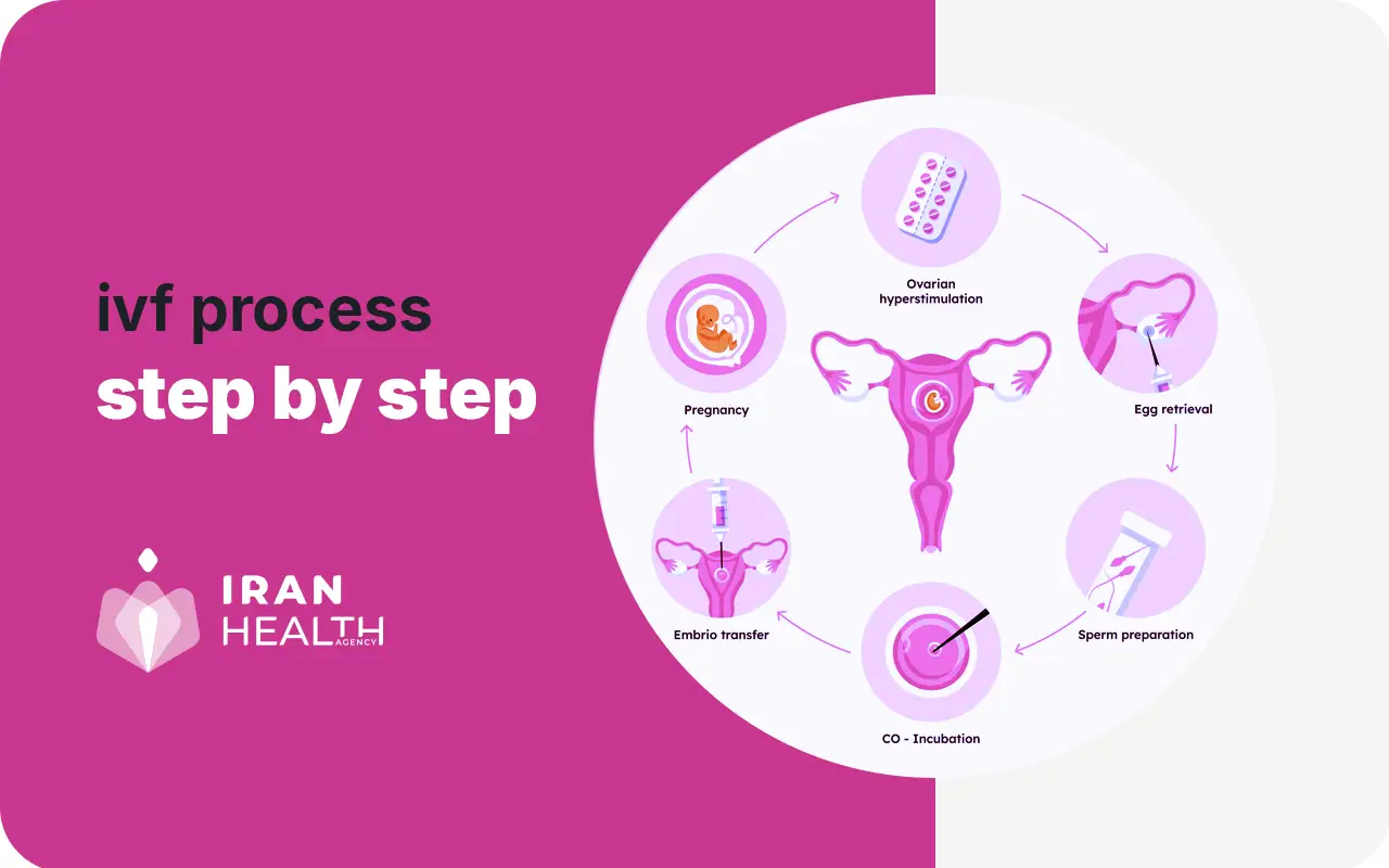 IVF procedure step by step