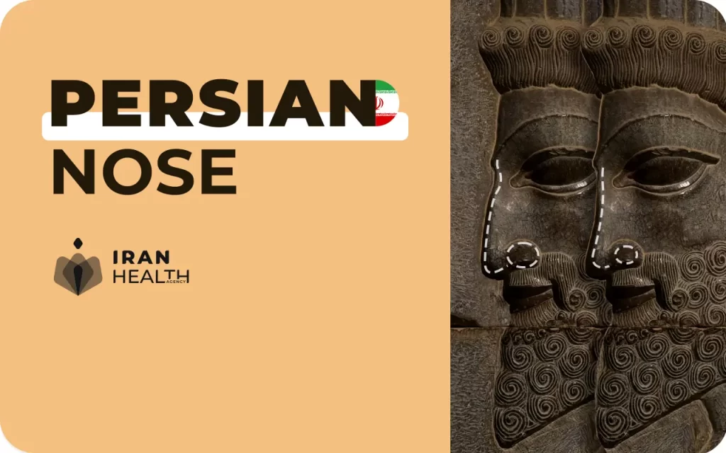 Persian nose