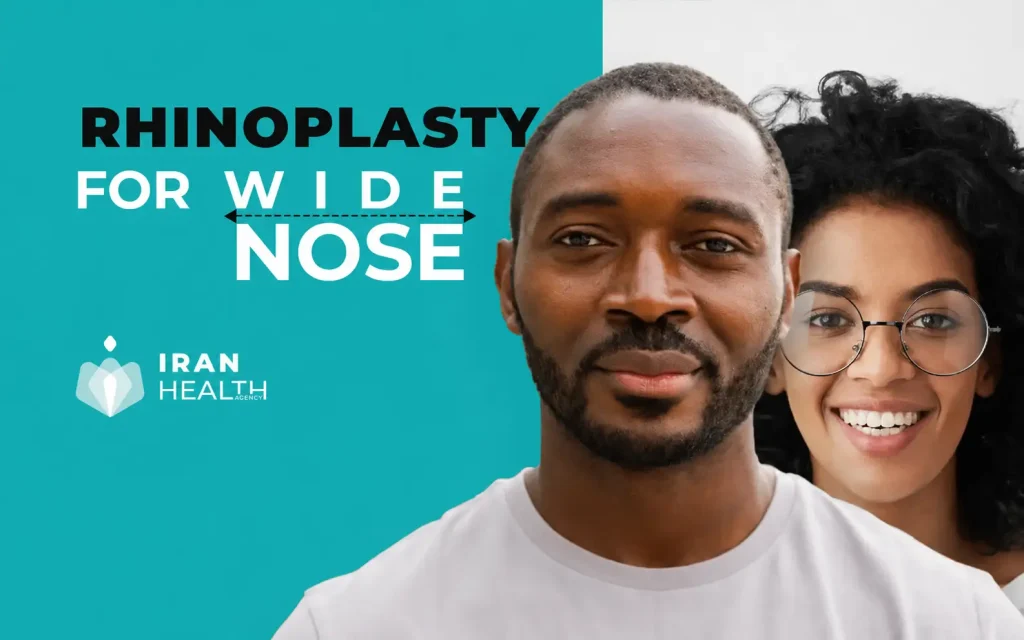 Rhinoplasty for wide nose 1