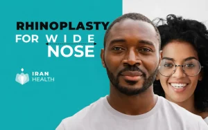 Rhinoplasty for wide nose 1
