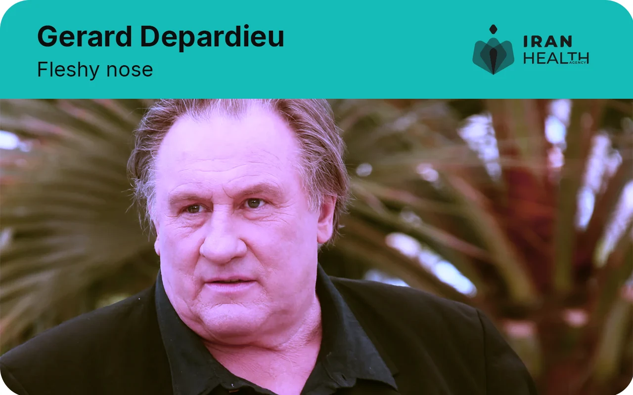 Fleshy nose Gerard Depardieu