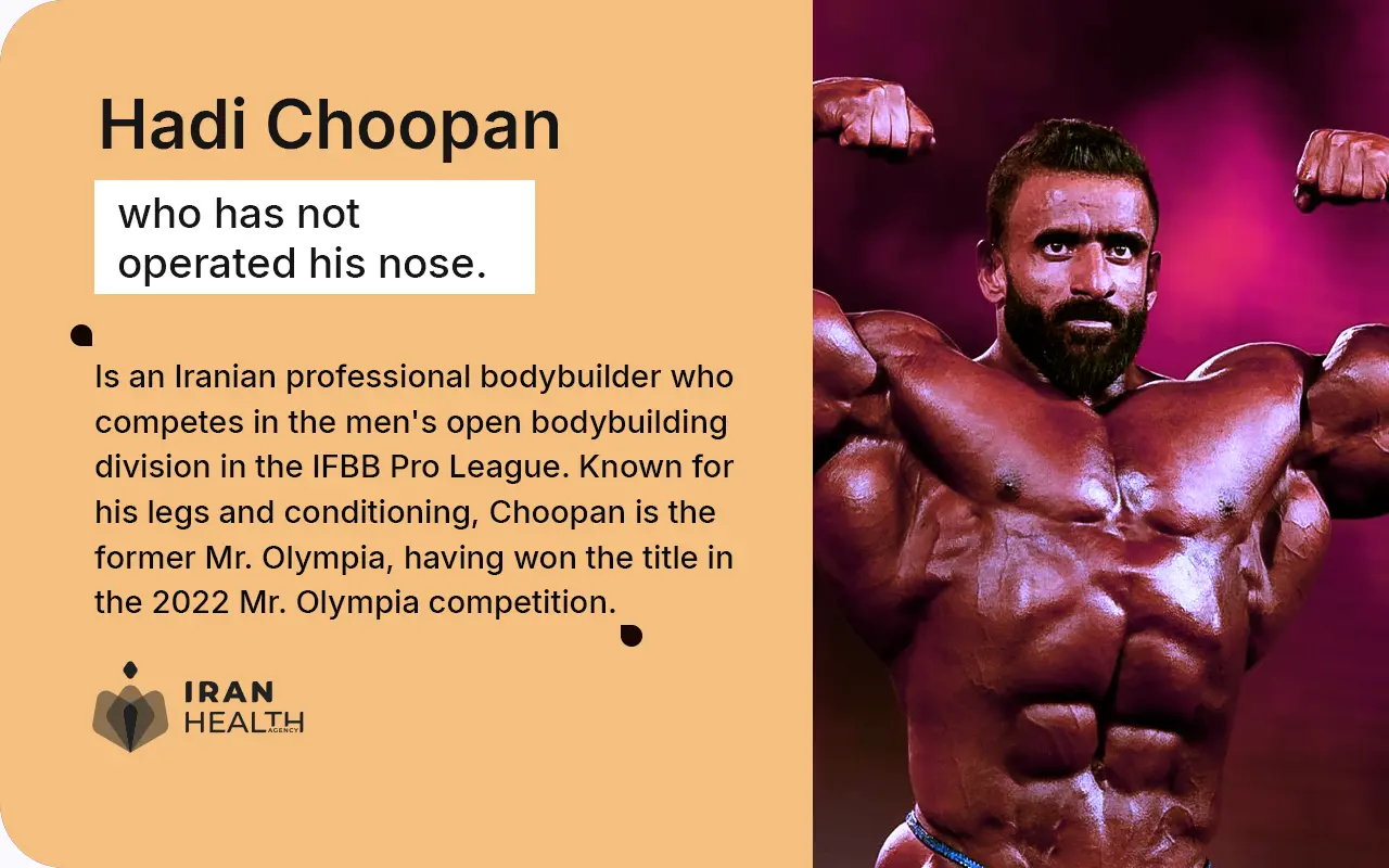 Hadi Choopan's Persian nose