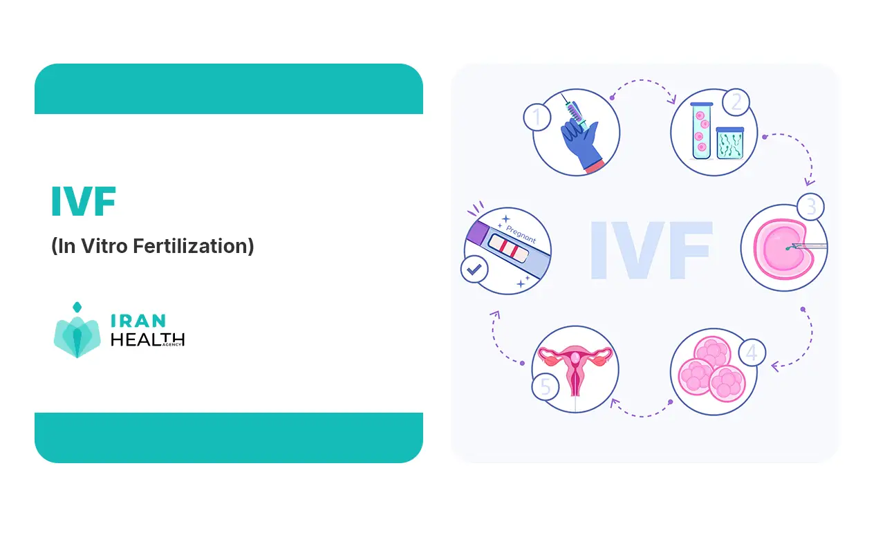 How prevalent is infertility in Iran IVF