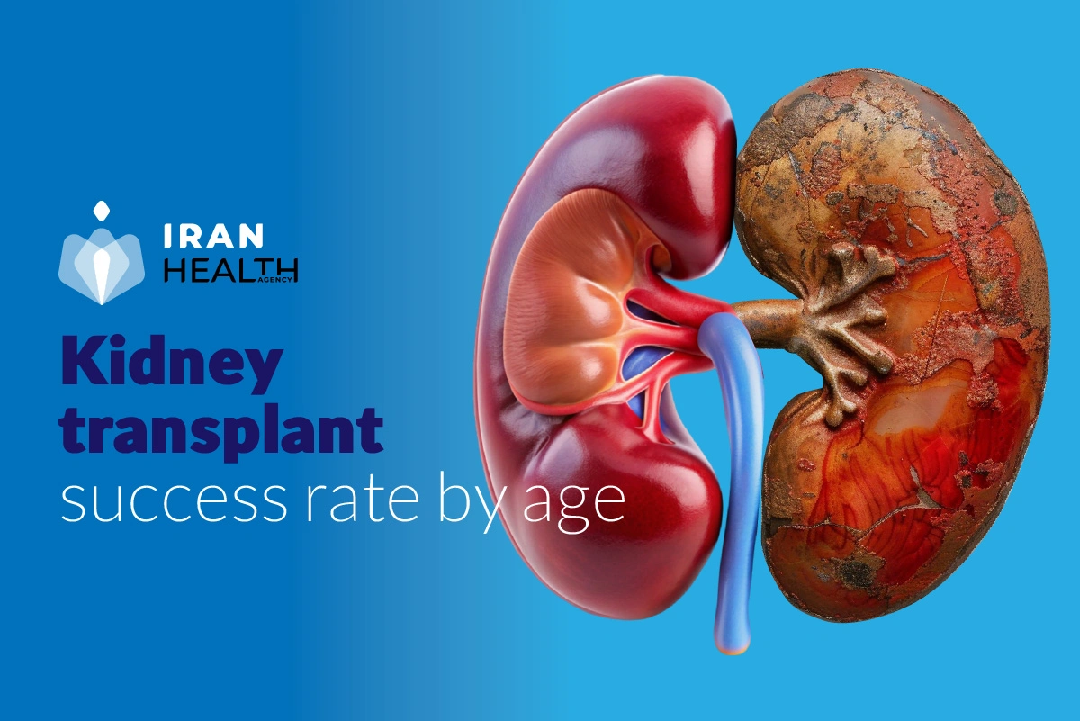 Kidney transplant success rate by age