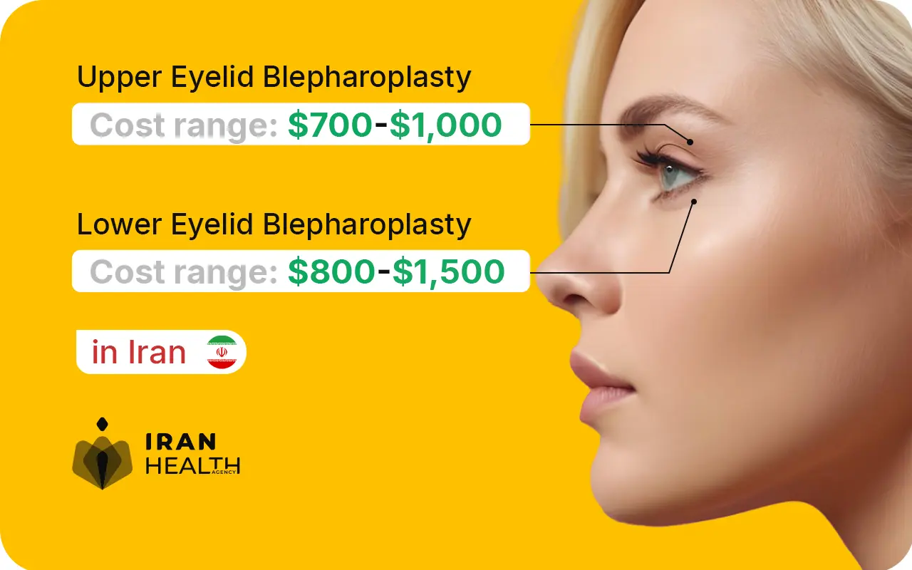 Upper blepharoplasty cost