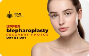 Upper blepharoplasty recovery photos day by day