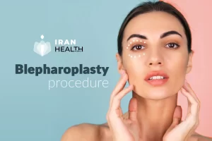 blepharoplasty procedure