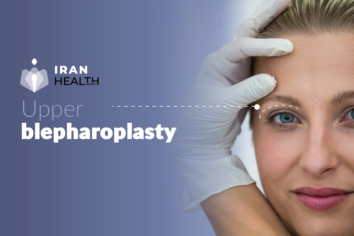 upper blepharoplasty procedure