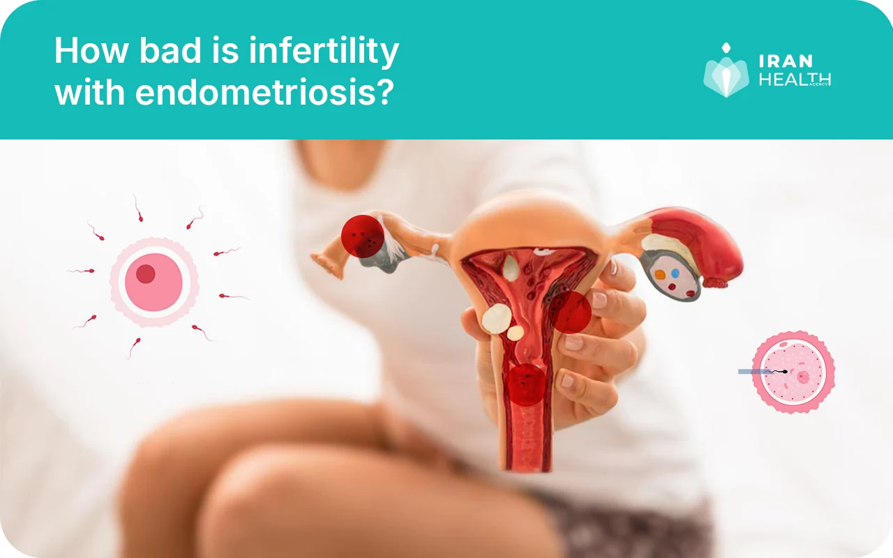 How bad is infertility with endometriosis