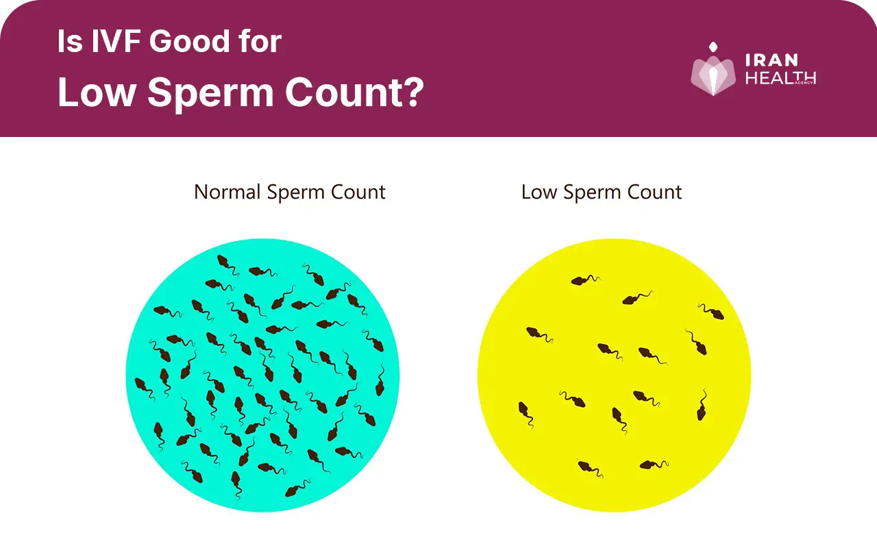 Is IVF Good for Low Sperm Count