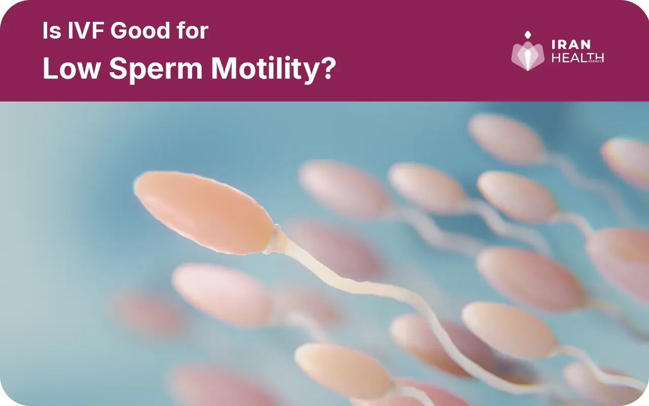 Is IVF Good for Low Sperm Motility