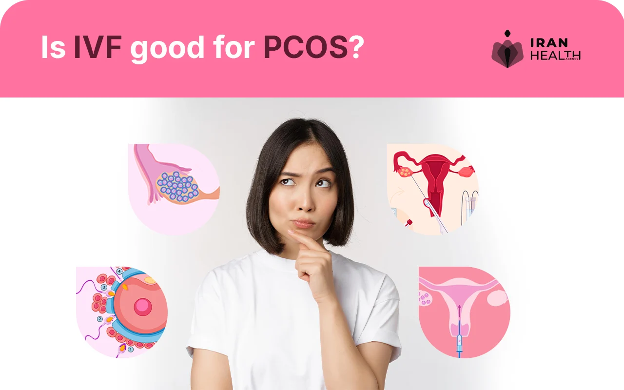  Is IVF good for PCOS