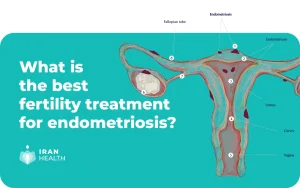 What is the best fertility treatment for endometriosis