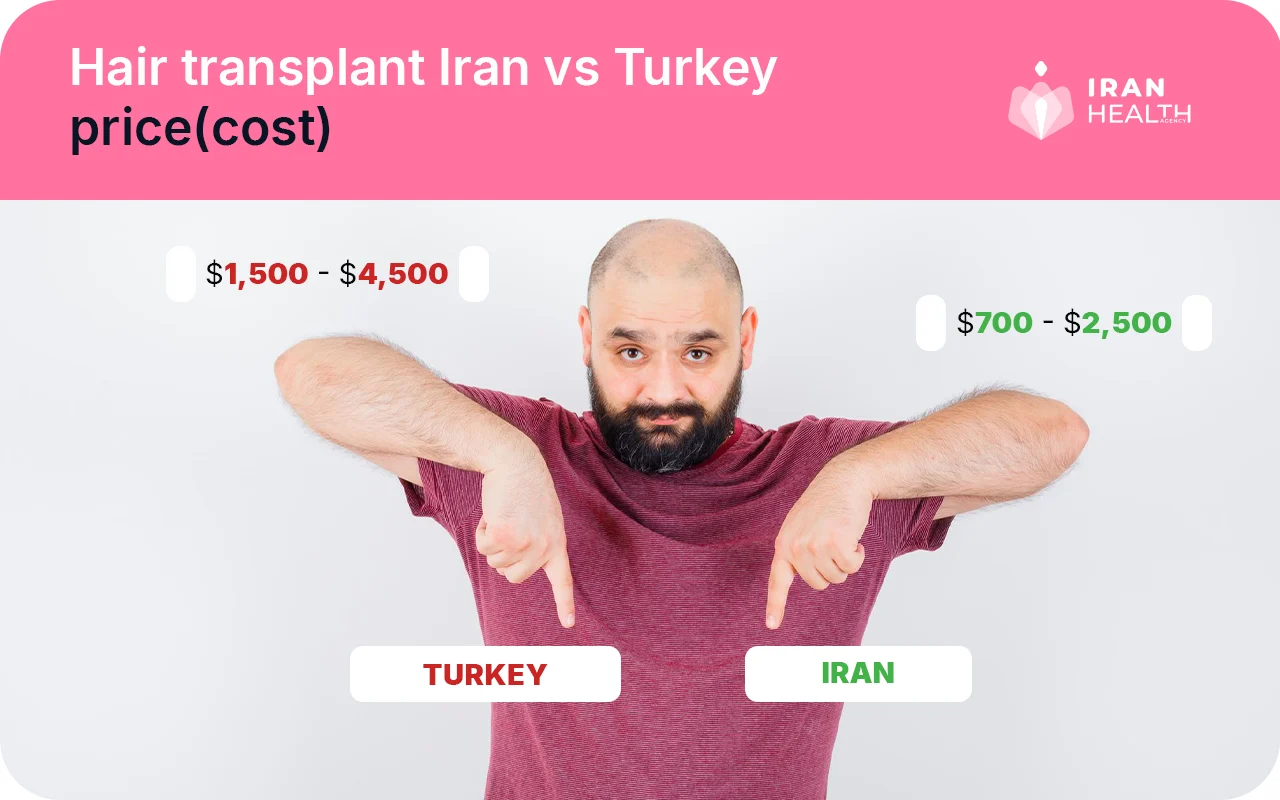 Hair transplant Iran vs Turkey price(cost)