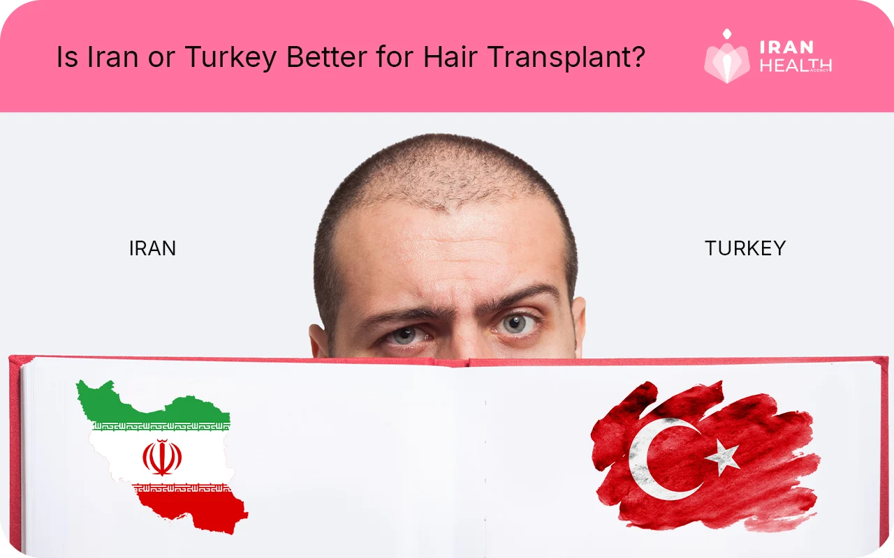 Is Iran or Turkey Better for Hair Transplant