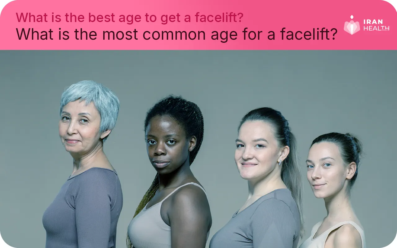 What is the most common age for a facelift