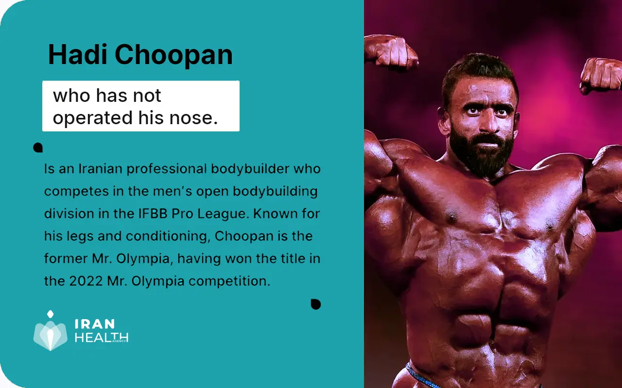 Hadi Choopans Persian nose copy