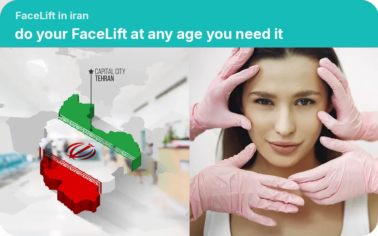 Facelift-in-Iran-Do-your-facelift-at-any-age-you-need-it