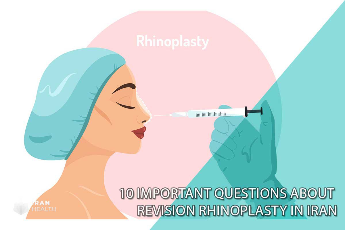 10 important questions about revision rhinoplasty in Iran