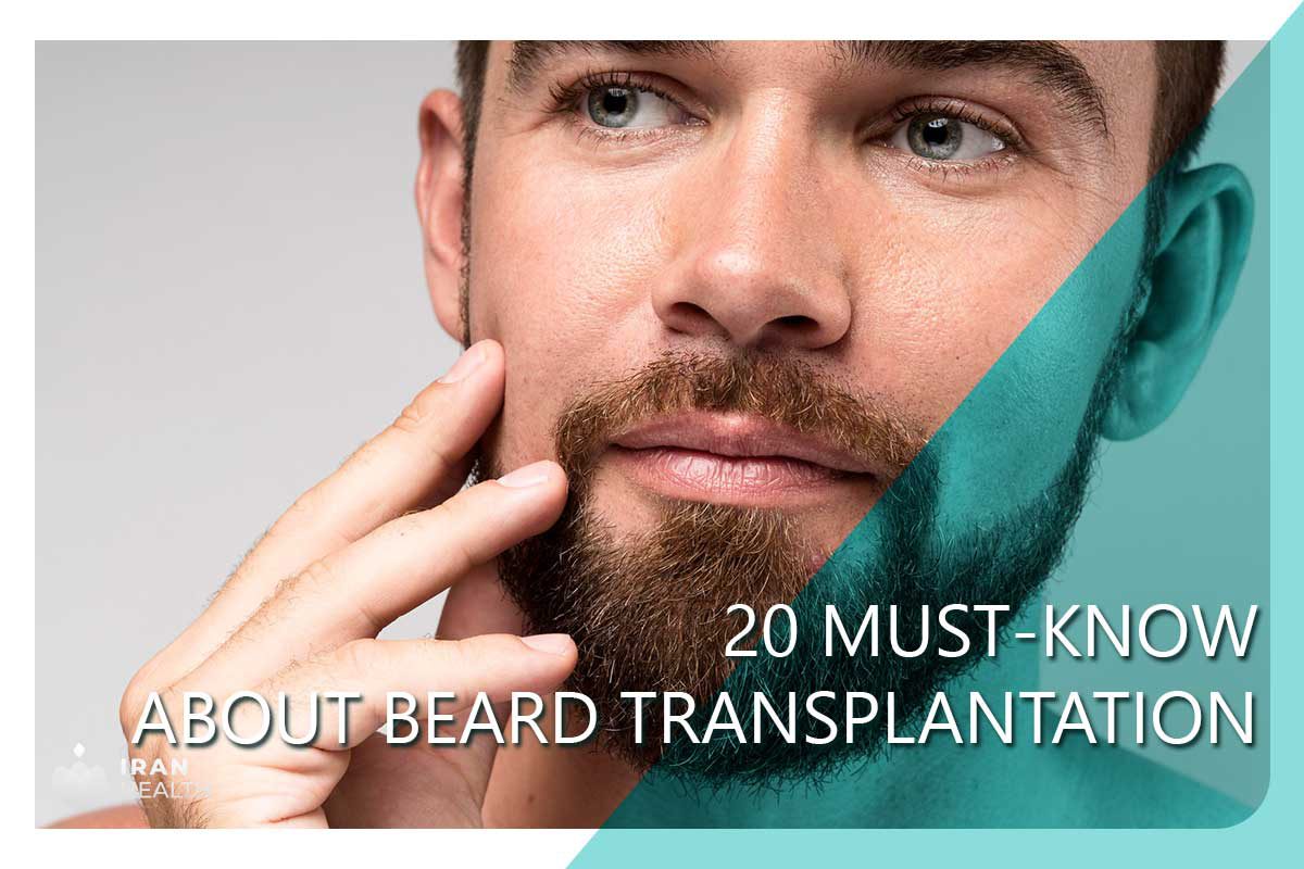 20 must-know about beard transplantation