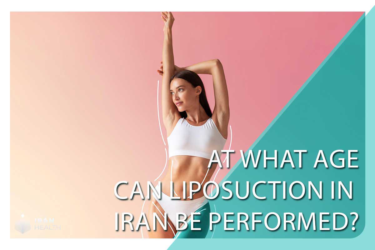 At what age can liposuction in Iran be performed?