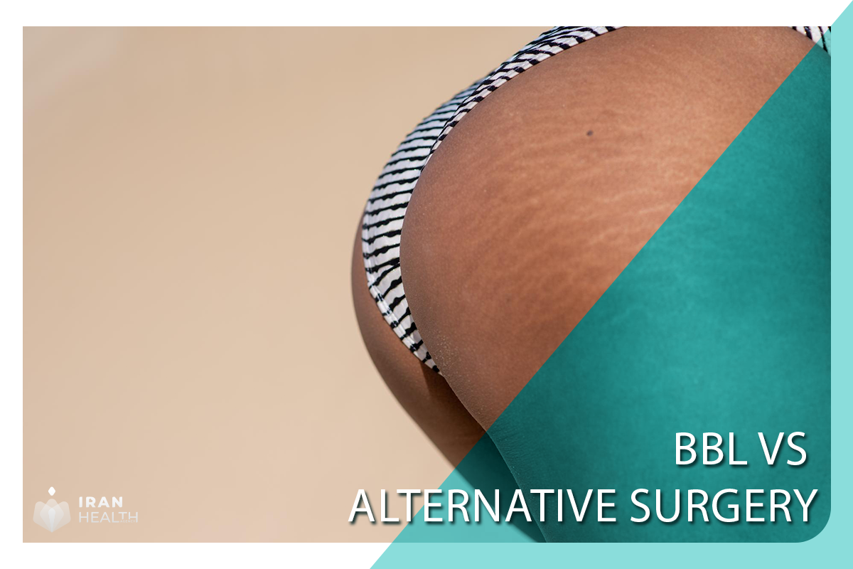BBL vs Alternative Surgery