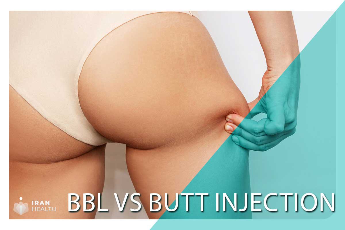 BBL vs Butt Injection