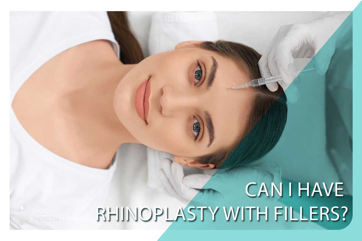 Can I have rhinoplasty with fillers?