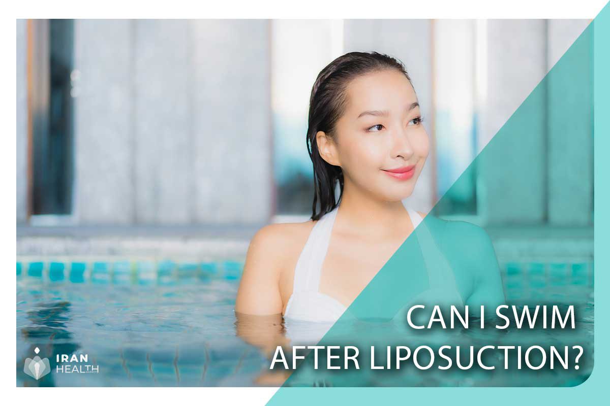 Can I swim after Liposuction?