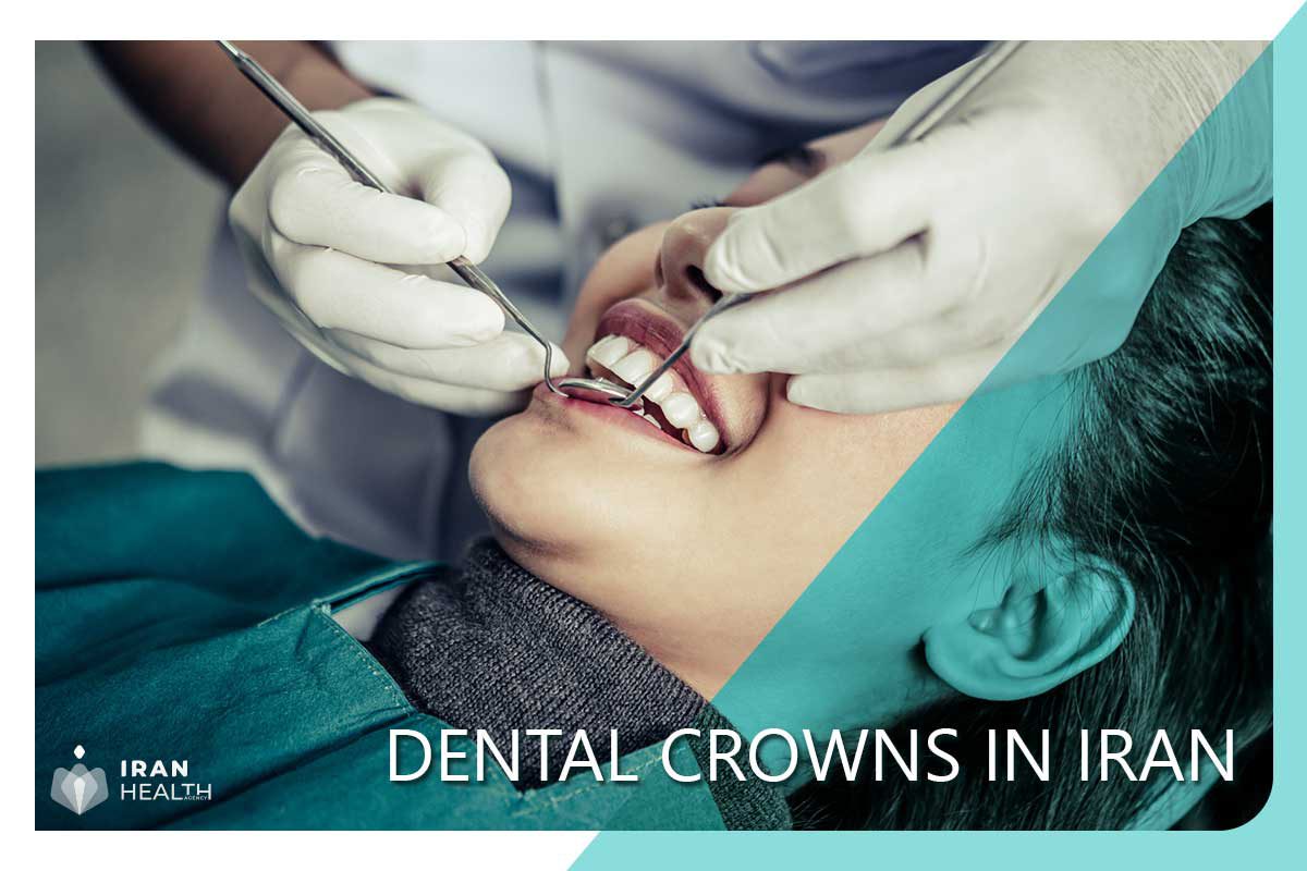Dental crowns in Iran