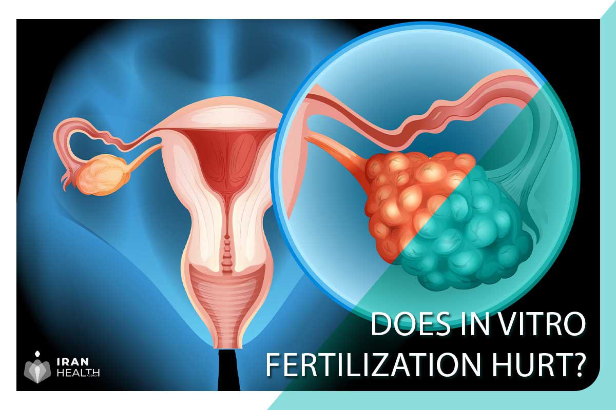 Does in vitro fertilization (ivf) hurt? 