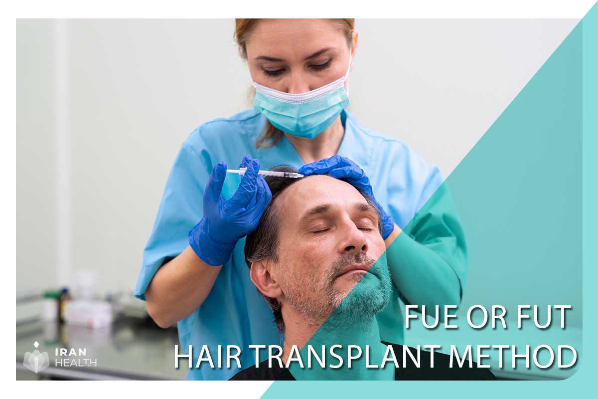 FUE or FUT hair transplant method