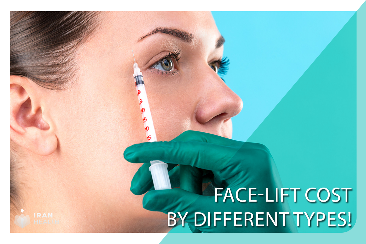 Face-lift Cost by Different Types!