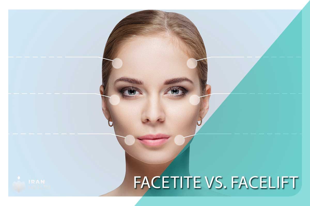 FaceTite vs. Facelift