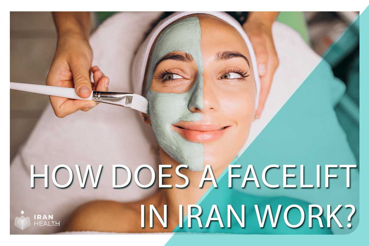 How does a facelift in Iran work?