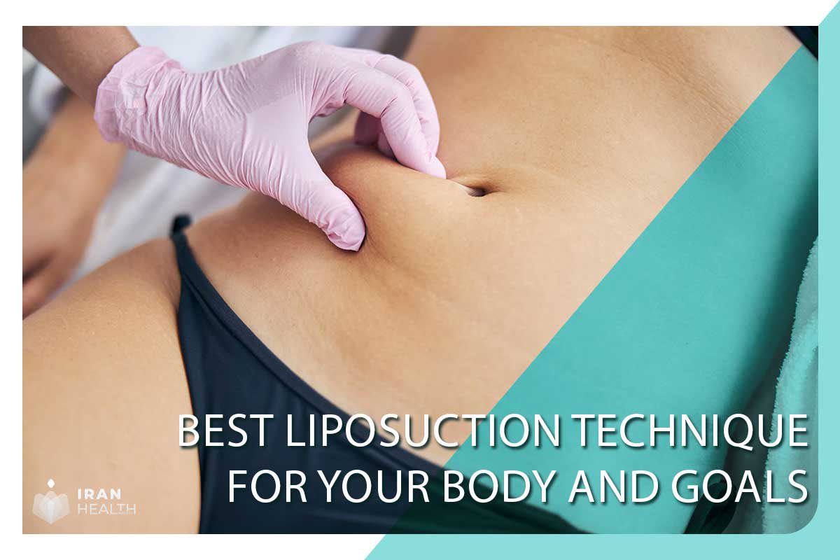 How to Choose the Best Liposuction Technique for Your Body and Goals