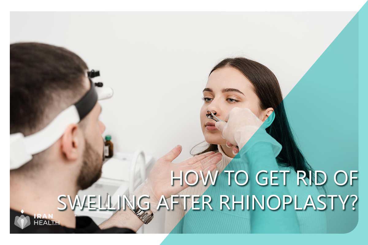 How to get rid of swelling after Rhinoplasty?