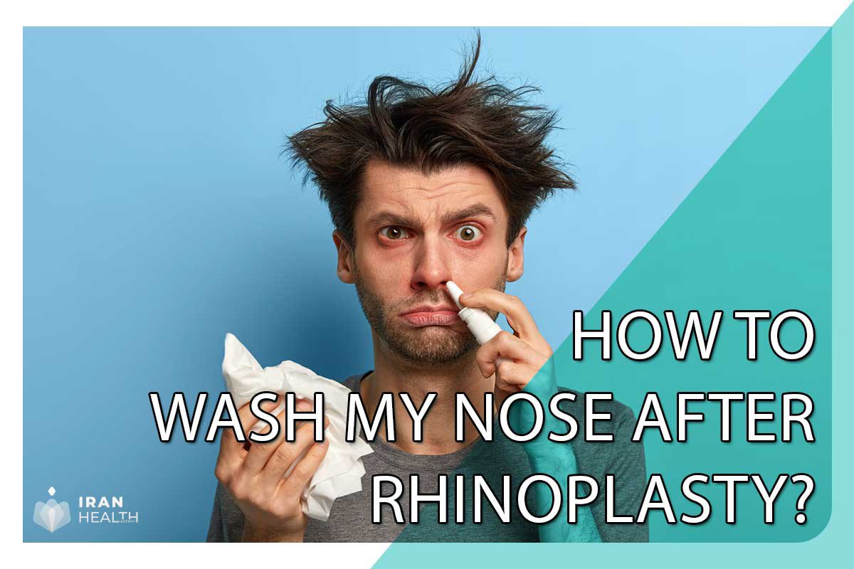 How to wash my nose after rhinoplasty?