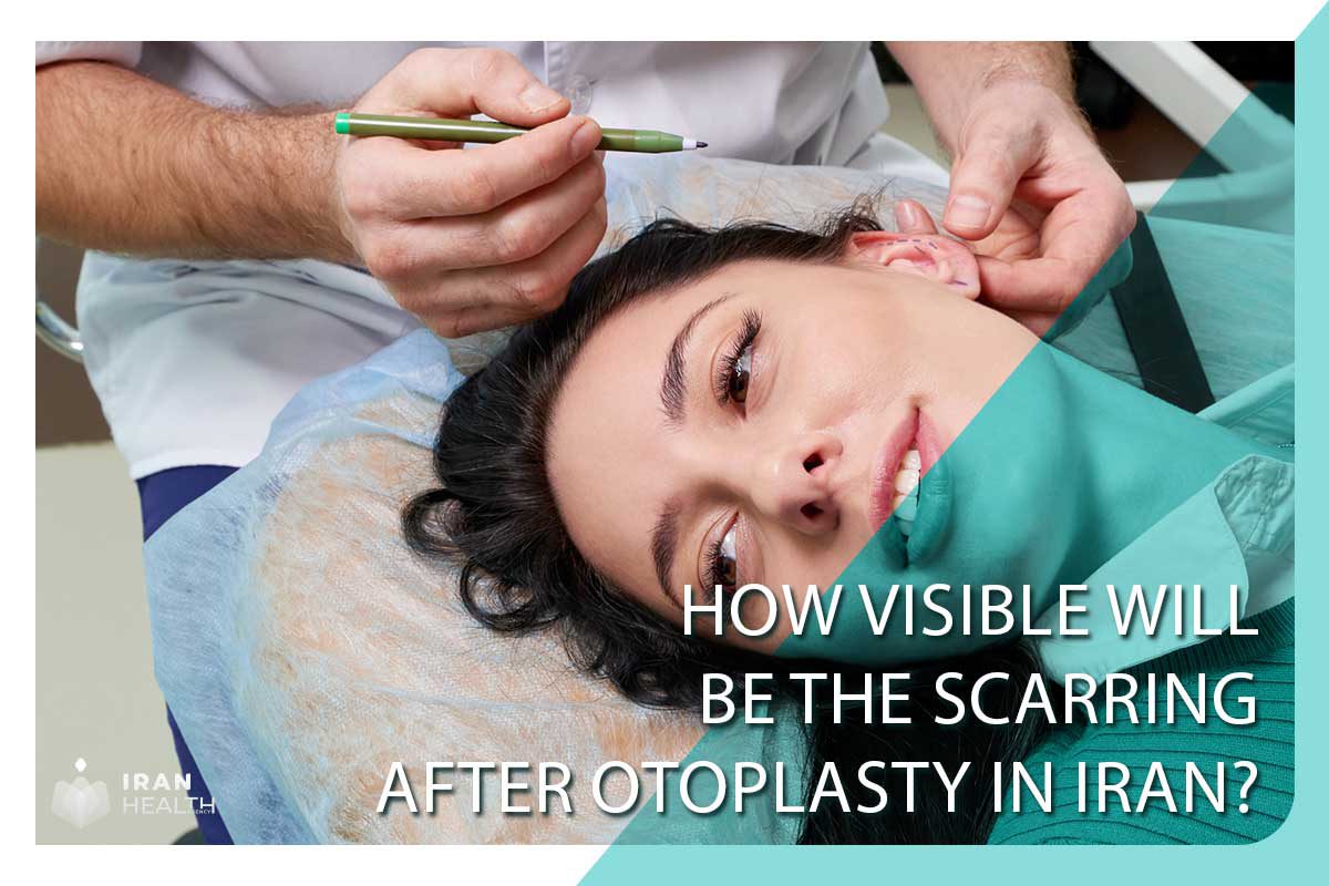How visible will be the scarring after otoplasty in Iran?