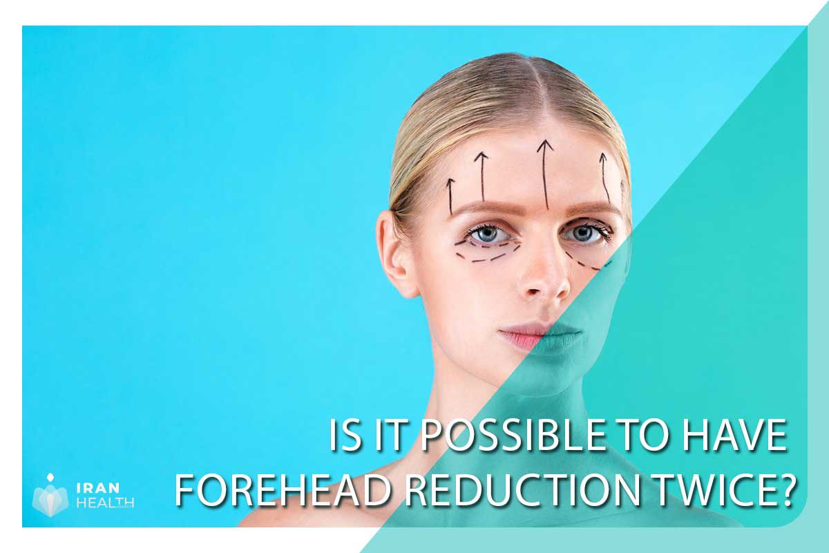 Is it possible to have forehead reduction twice?