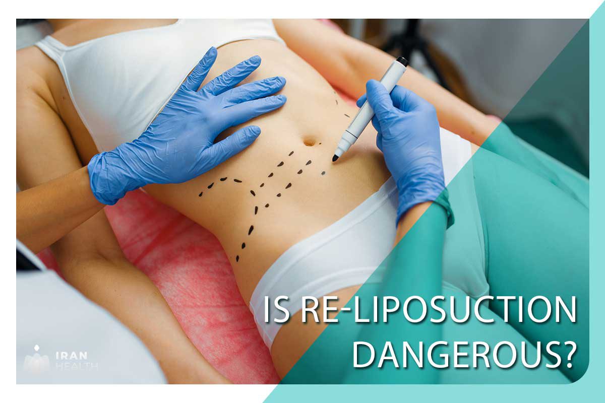 Is re-liposuction dangerous?