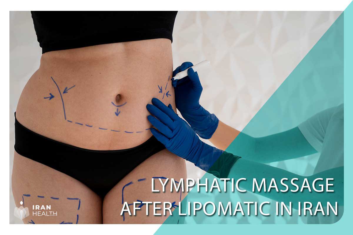 Lymphatic-massage-after-lipomatic-in-Iran