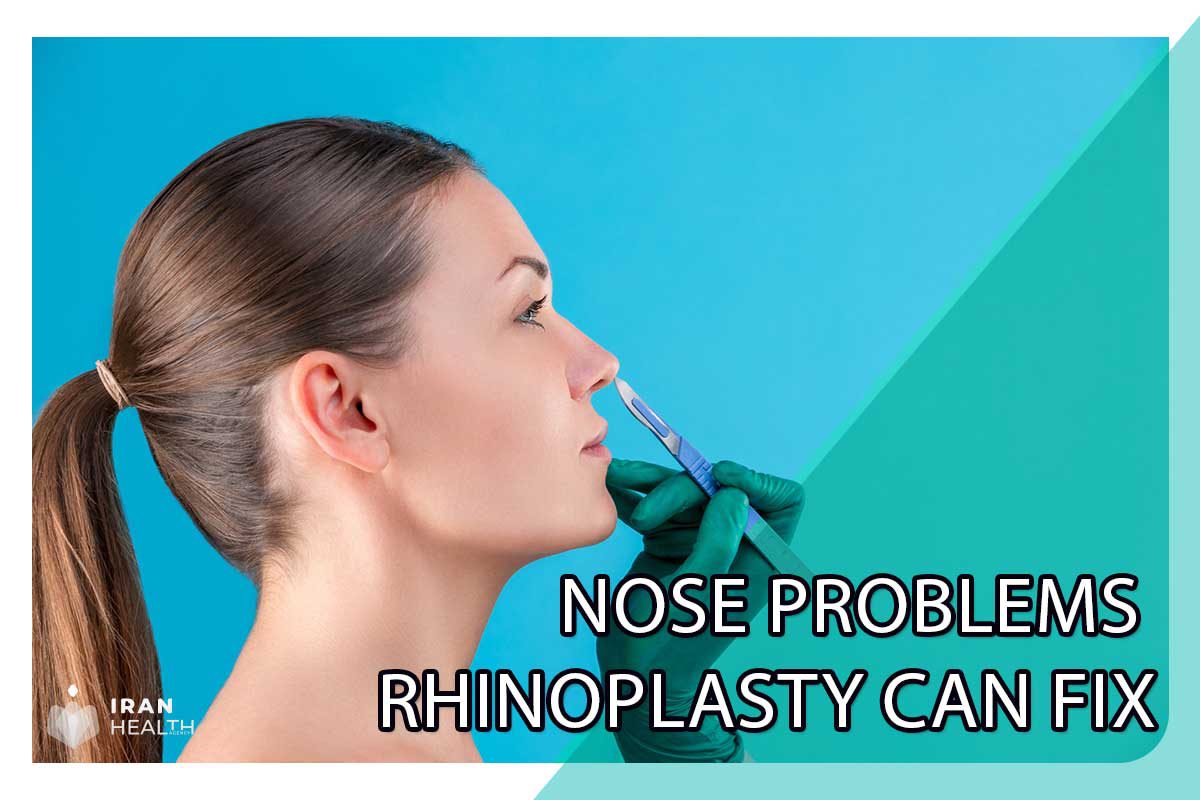 Nose Problems Rhinoplasty Can Fix